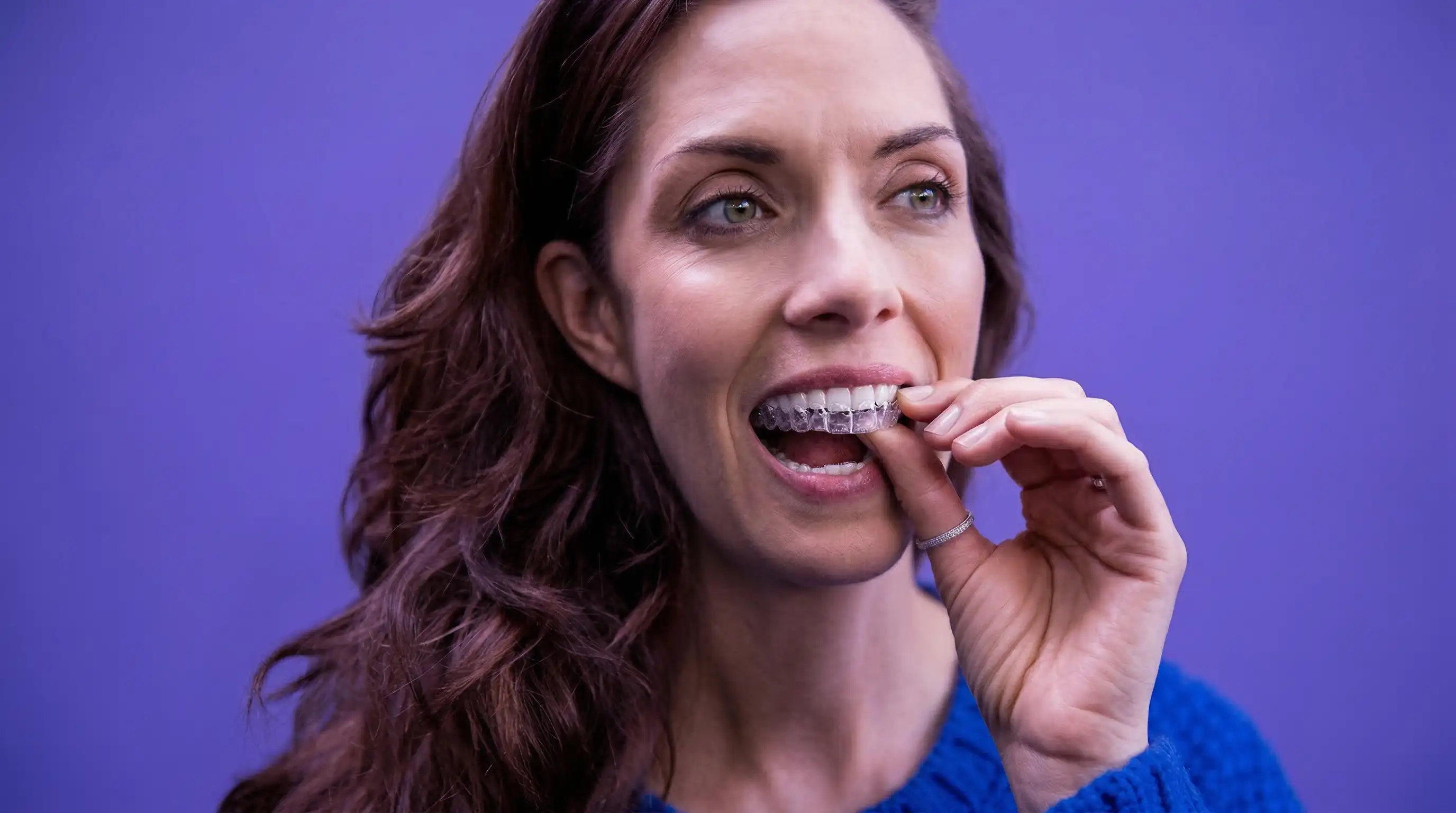 Invisalign Behandlung bei ShapeMySmile